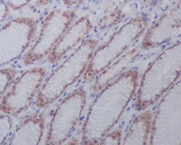 IHC - Anti-active + pro Caspase 3 CASP3 Rabbit Monoclonal Antibody ABO14291